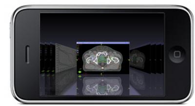GPU and Cloud-based Next Generation Cancer Radiotherapy Treatment Planning