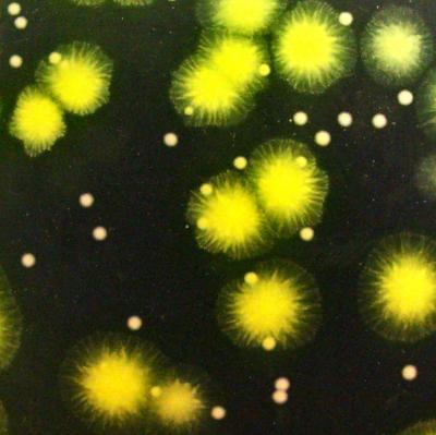Bacterial Colonies of Cooperators (green) and Cheats (white), Growing on Agar