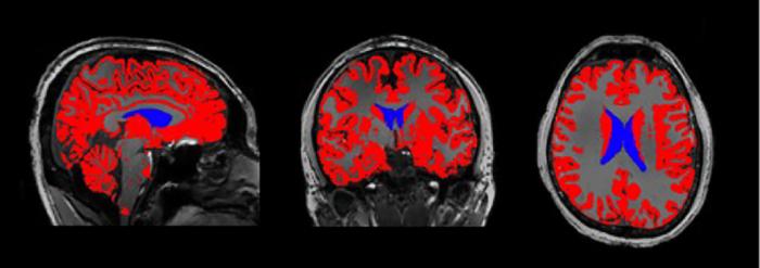 Cerebrospinal fluid and deep sleep