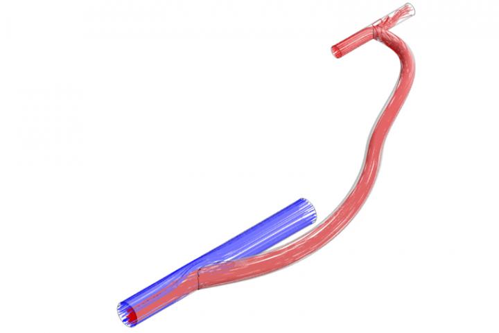 Arteriovenous graft