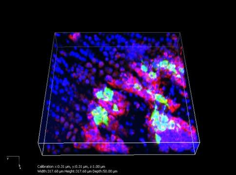 Osteoblasts Protecting Cancer Cells