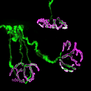 Representative images of neuromuscular junctions in model animals used in the experiment. Motor nerves are colored in green and receptors on muscul fibers are colored in purple. The picture on the right was taken at low magnification (100x) whereas the left picture was taken at high magnification (600x).