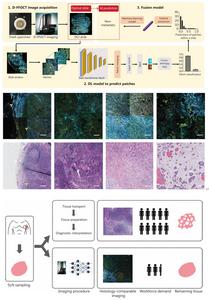 From virtual imaging to real-time lymph node diagnosis.