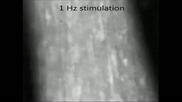 Human Engineered Muscle
