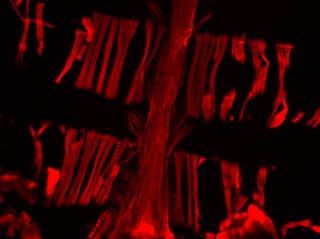Vinculin-Overexpressing Heart of a Fruit Fly