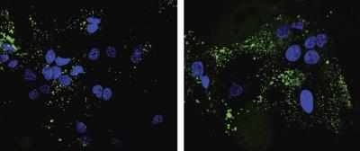 Liver Cells Lacking GAPDH