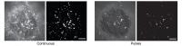 Activation of Striatal Neurons with Patterned Stimulation