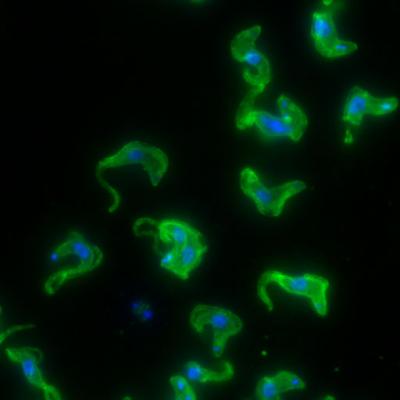 Sleeping Sickness Parasites