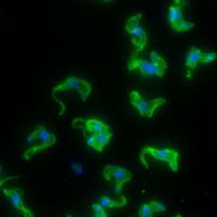 Sleeping Sickness Parasites