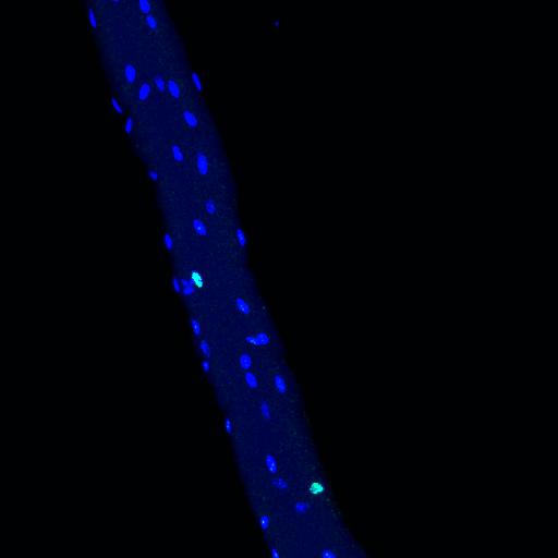 Nuclei with different gene expression patterns