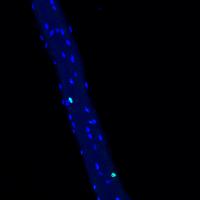 Nuclei with different gene expression patterns