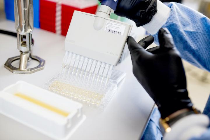 Saliva Diagnostics