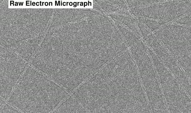 3-D structure of the amyloid fibril