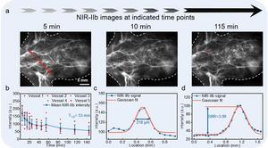 Figure 3 | In vivo evaluation of Er@50Yb@ICG@DSPE-PEG2000 nanoprobes