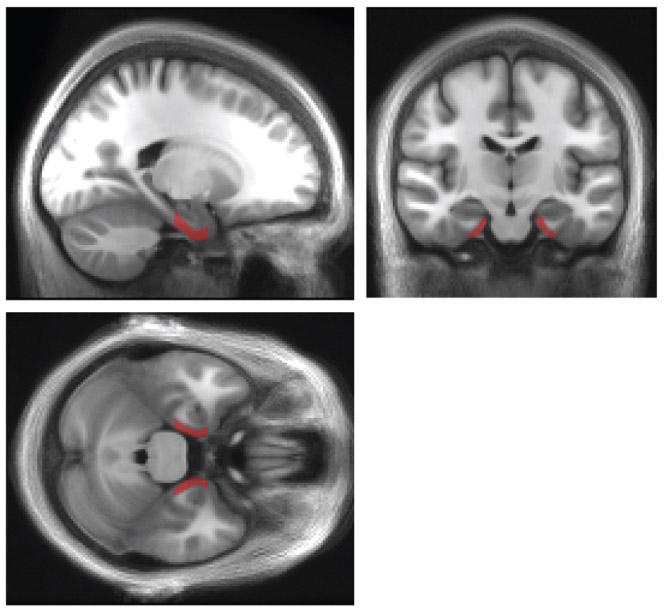 Entorhinal Cortex From 3 Views