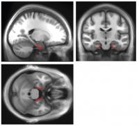 Entorhinal Cortex From 3 Views