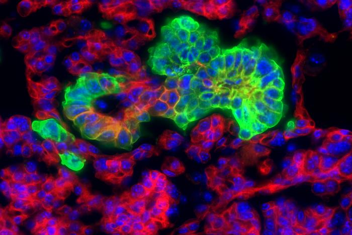 Highly Plastic Cancer Cells