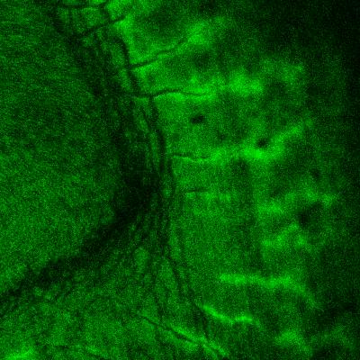 Toothpick: New Molecular Tag IDs Bone and Tooth Minerals (1 of 2)