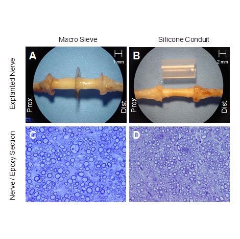 Nerve Regeneration