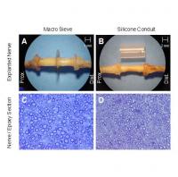 Nerve Regeneration