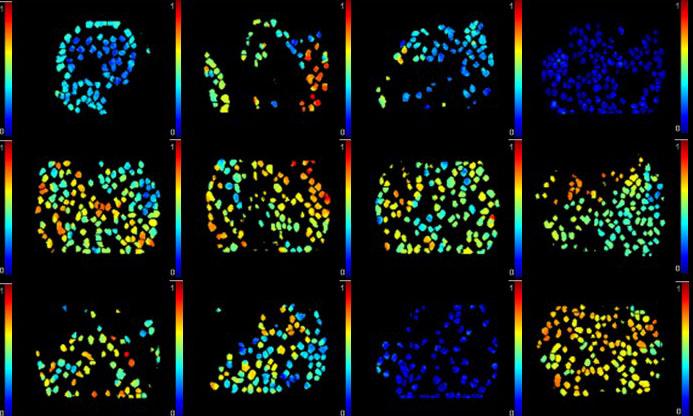 Imaging Individual Cancer Cells in a Tumor in Vivo