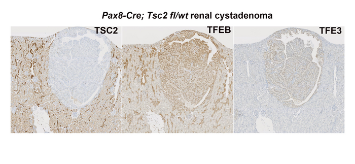 Murine renal tumors