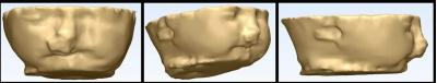 3-D Printed Fetal Head