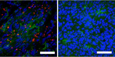 A No-Needle Nanocapsule Vaccine (1 of 2)
