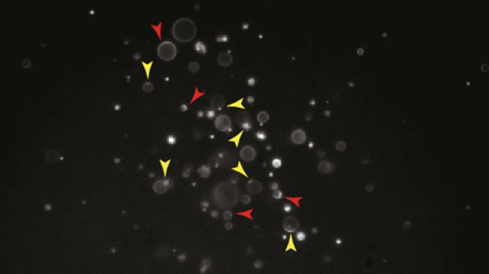 Polymer vesicles