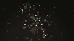 Polymer vesicles