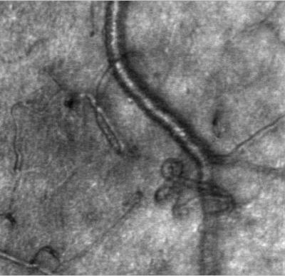 Retinal Capillary