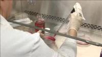 Genetic Mutation for ALS Discovered