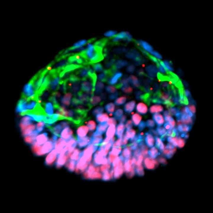 Post-Implantation Amniotic Sac Embryoid