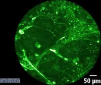 Imaging Platform Captures Hard-to-Track Bacterial Lung Infections in Real Time (2 of 2)