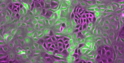 Mixed cells - extensile and contractile