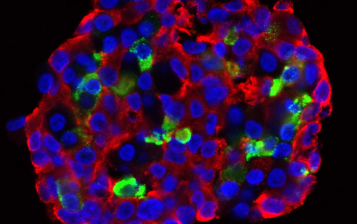 Beta Cell