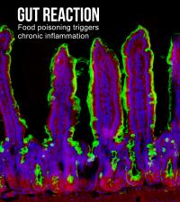 Food Poisoning Trigger Chronic Inflammation