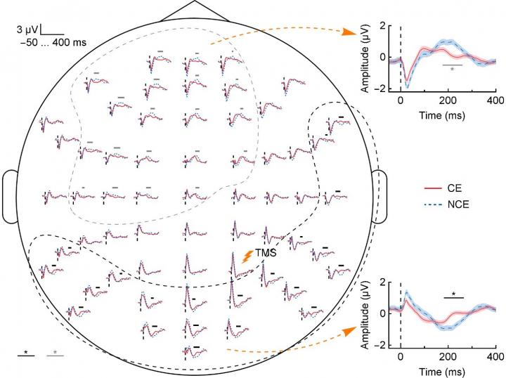 TMS-EEG (2 of 2)