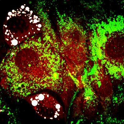 Fat Storage in Cells
