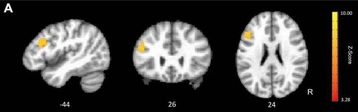 Neural Efficiency