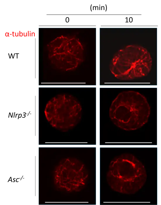 Role of inflammasome proteins: NLRP3 and ASC