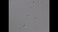 Coral cells capture dinoflagellates for symbiosis