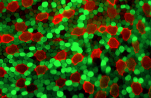 AAV-infected light-sensing cells in the retina