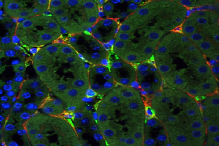 Gene Therapy Method Developed to Target Damaged Kidney Cells