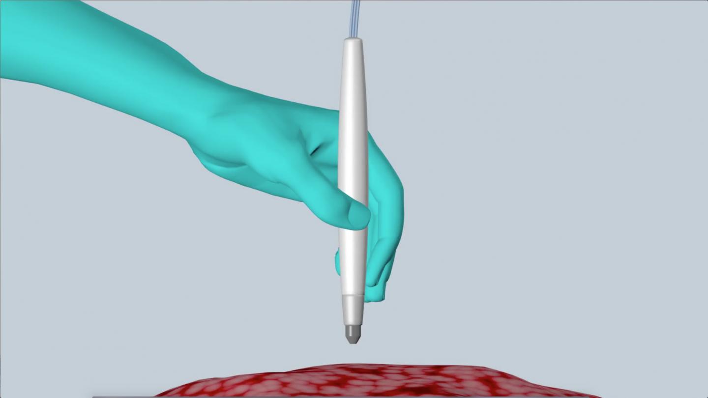 The MasSpec Pen 2