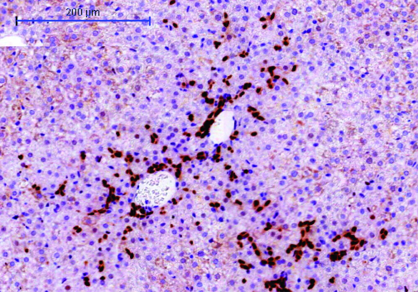 Hepatic Progenitor Cells
