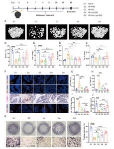 Fig. 5. Targeted clearance of senescent cells in bone tissue alleviates radiotherapy-induced osteoporosis.