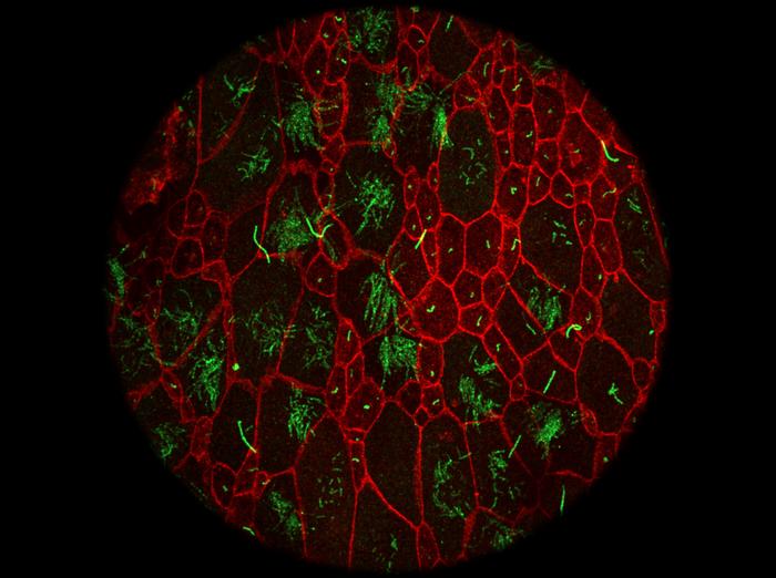 Primary cilia