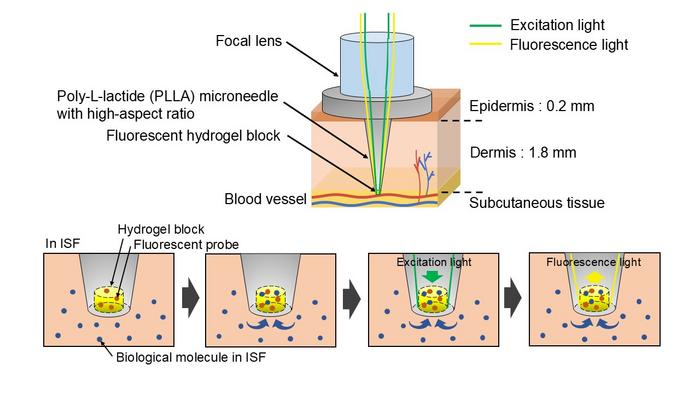 Schematic illustration of in vivo fluorescence sensing using a microneedle