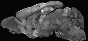 Brain Slice